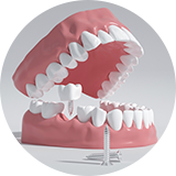 1. 发送您的石膏模型